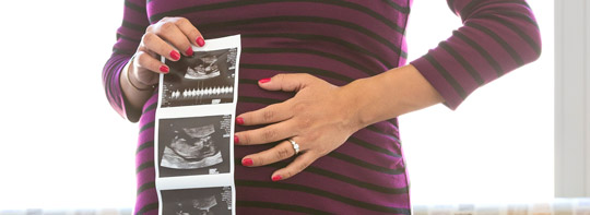 Photo of a pregnant woman with ultrasound images.
